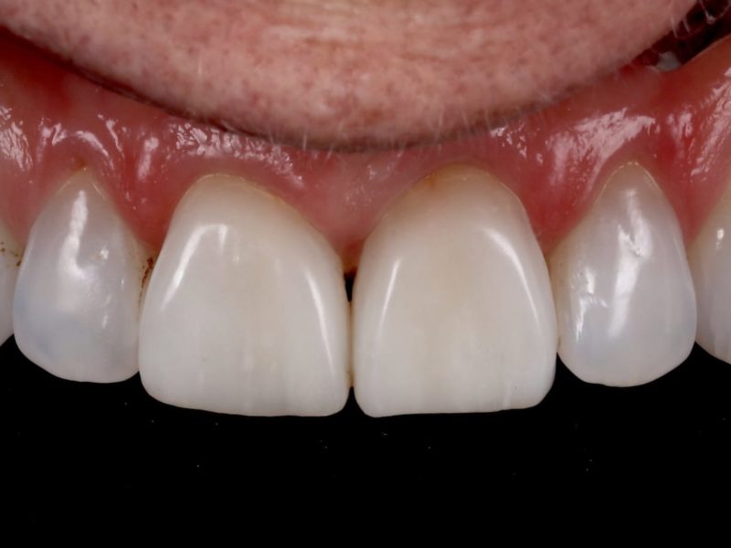 A-Z of Restorative Dentistry