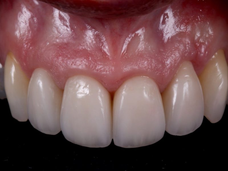 A-Z of Restorative Dentistry