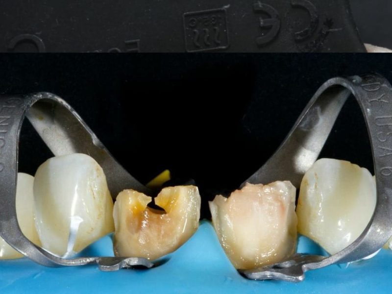 A-Z of Restorative Dentistry