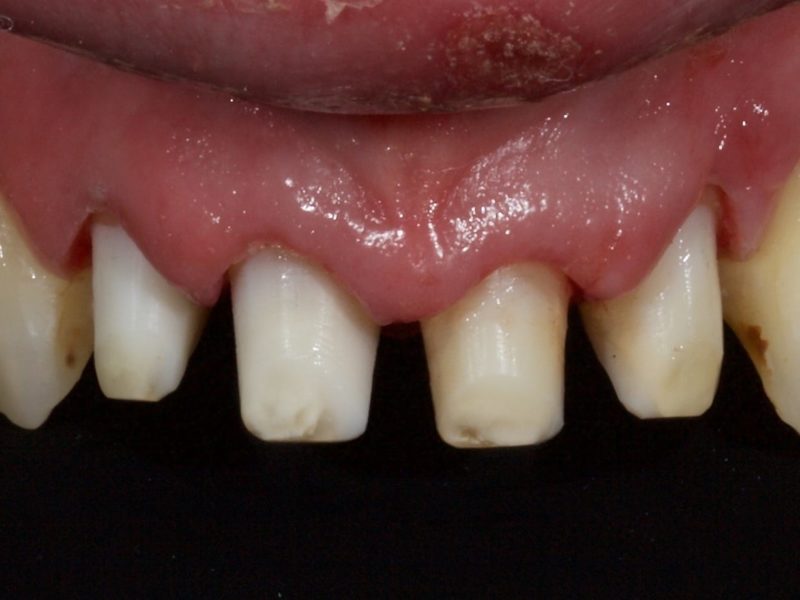 A-Z of Restorative Dentistry