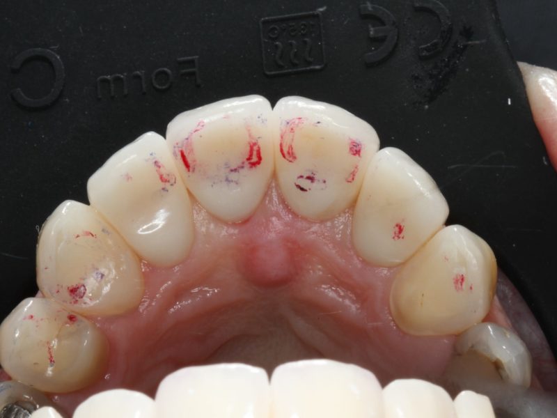 A-Z of Restorative Dentistry