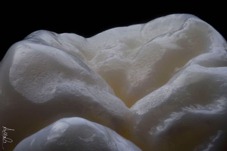 Restorative & Composite Dental Courses The Restorative Programme